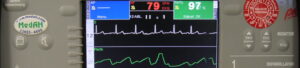 Closeup of a defibrillator/monitor/pacer from an ambulance in Graz, Austria. For a picture of the whole defibrillator, see the link below. https://commons.wikimedia.org/wiki/File:Defibrillator_Monitor_Closeup.jpg